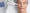 Microneedling mit Skin Needler von Reviderm