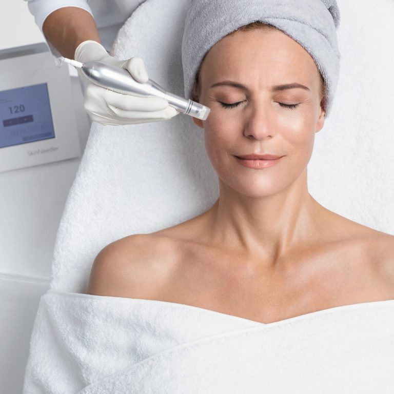 Skinneedler Microneedling
